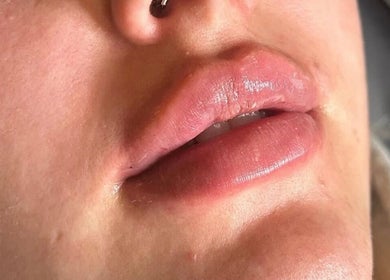 Close-up of enhanced lips at The Beauty Shack by Demileigh, Shirebrook, England, GB.