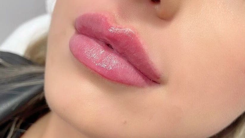 Close-up of enhanced lips at Charelles Aesthetics, Uddingston, Scotland, GB, showcasing expert lip treatment.