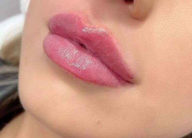 Close-up of enhanced lips at Charelles Aesthetics, Uddingston, Scotland, GB, showcasing expert lip treatment.
