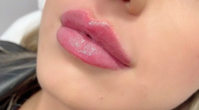 Close-up of enhanced lips at Charelles Aesthetics, Uddingston, Scotland, GB, showcasing expert lip treatment.