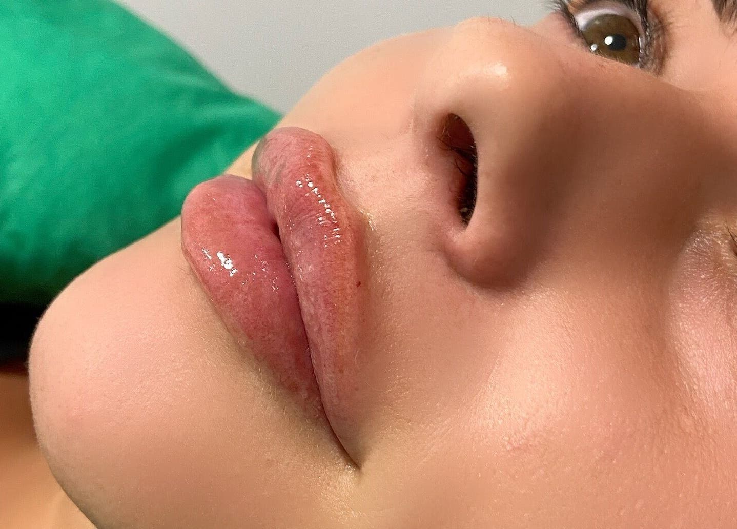Close-up of enhanced lips at Charelles Aesthetics in Uddingston, Scotland, GB, showcasing beauty treatment.