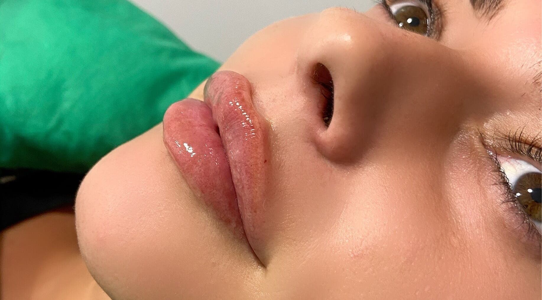 Close-up of enhanced lips at Charelles Aesthetics in Uddingston, Scotland, GB, showcasing beauty treatment.