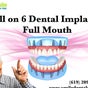 Tijuana Dentist Smile Dental Clinic - Calle Hermenegildo Galeana #8133, oficina 504, Zona Centro, Tijuana, Baja California
