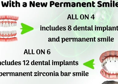 Dental implant options at Tijuana Dentist Smile Dental Clinic, Tijuana, Baja California, MX for a new smile.