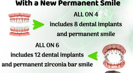Dental implant options at Tijuana Dentist Smile Dental Clinic, Tijuana, Baja California, MX for a new smile.