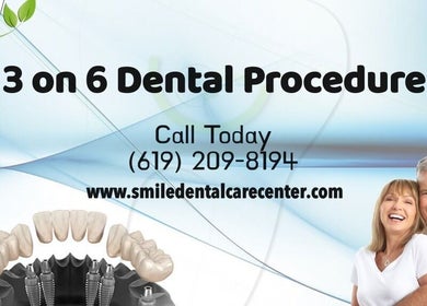 Happy clients at Tijuana Dentist Smile Dental Clinic in Tijuana, Baja California, MX for a 3 on 6 procedure.