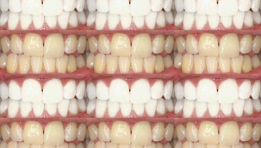 Vivid Pearl Cosmetic Teeth Whitening Studio image 1