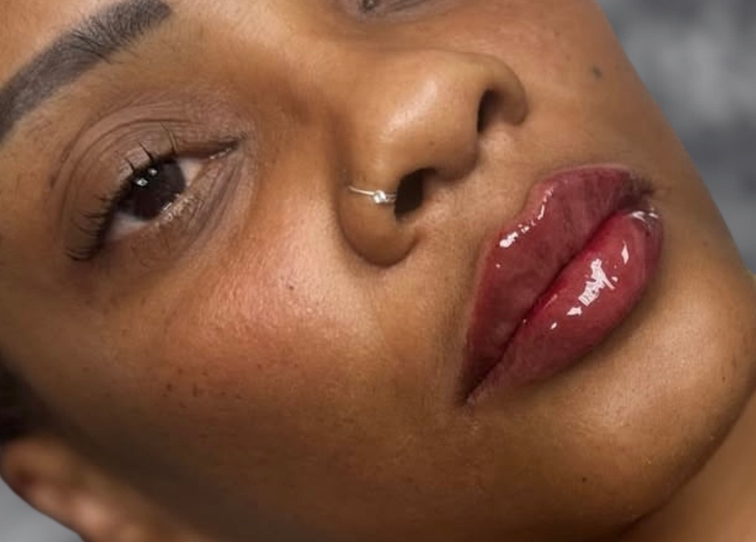 Close-up of a client's flawless skin and glossy lips at GLAM FACES CLINIC, Radlett, England, GB.