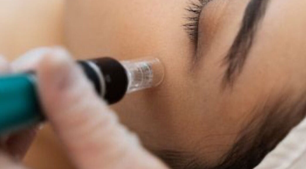 Facial treatment at Quinns Tanning and Aesthetics, London, England, GB, showcasing skin rejuvenation process.