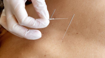 Key Point Acupuncture Farringdon изображение 2