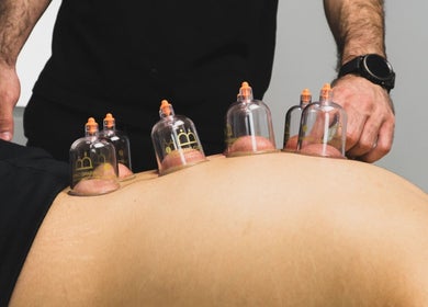 Cupping therapy session at Physio Vichas, Λατσιά, Λευκωσία, CY, promoting relaxation and wellness.
