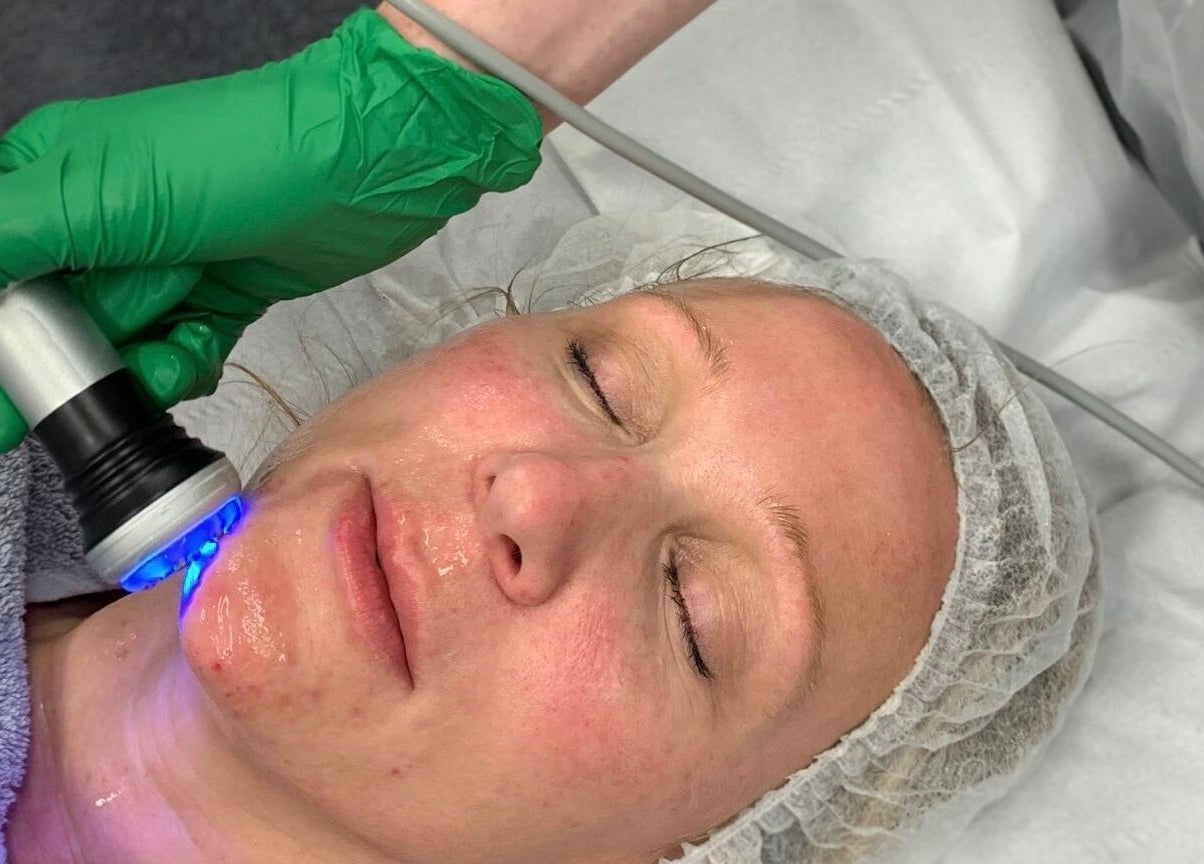 Advanced facial treatment at Elevate Skin Clinic in Macclesfield, England, GB, promoting radiant skin.