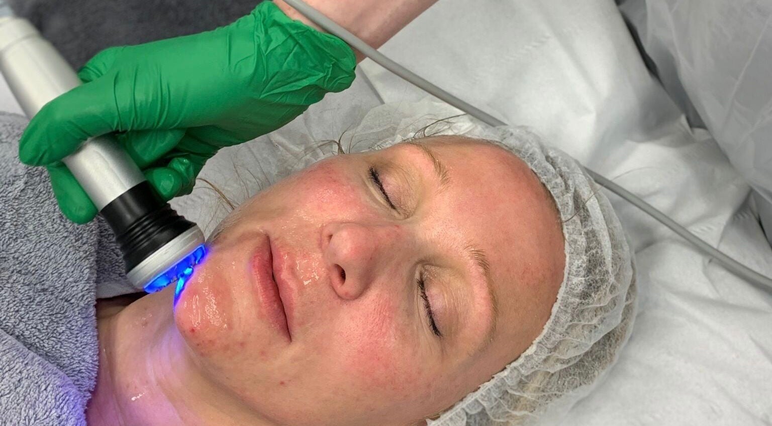 Advanced facial treatment at Elevate Skin Clinic in Macclesfield, England, GB, promoting radiant skin.