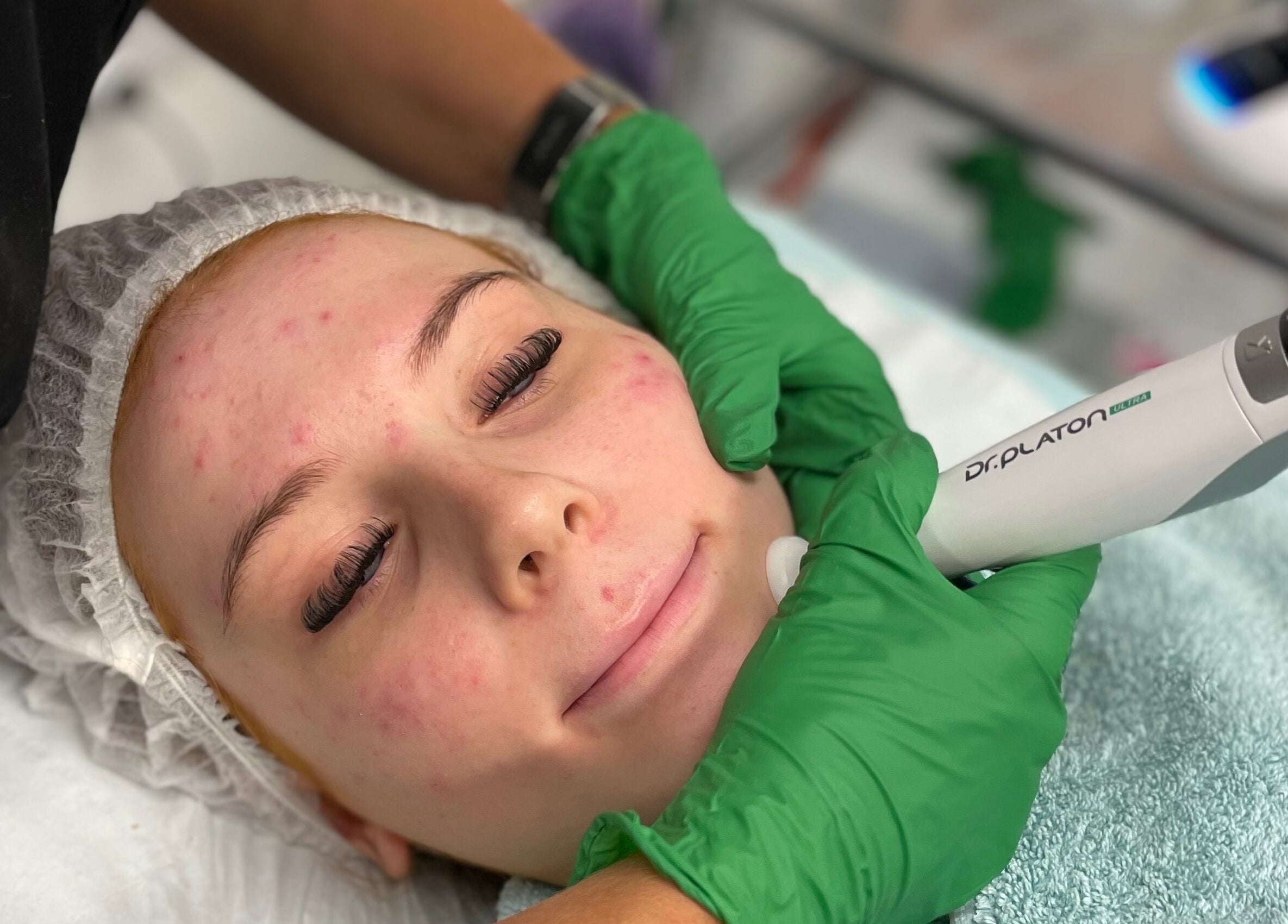 Facial treatment at Elevate Skin Clinic, Macclesfield, England, GB promoting healthy, glowing skin.