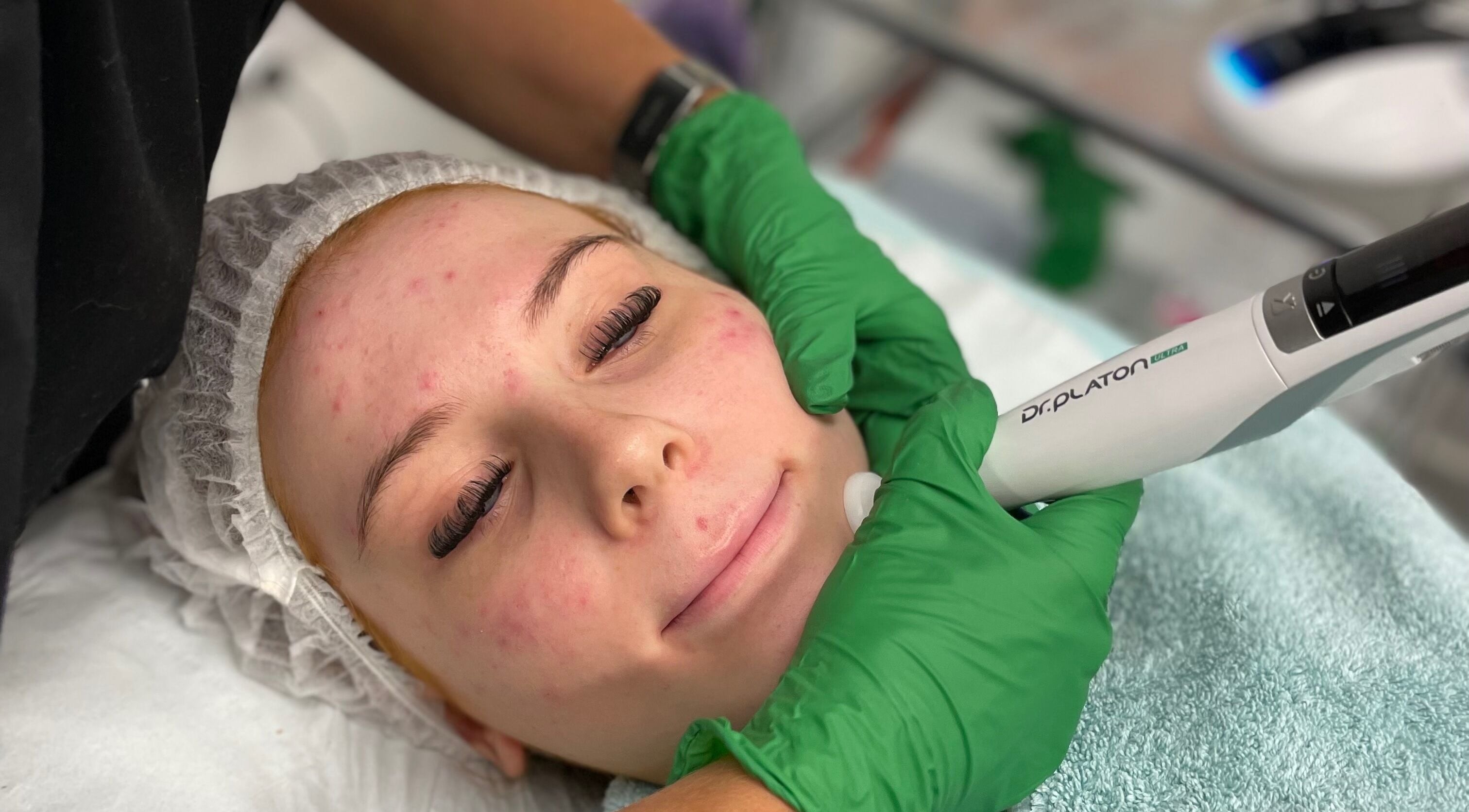 Facial treatment at Elevate Skin Clinic, Macclesfield, England, GB promoting healthy, glowing skin.