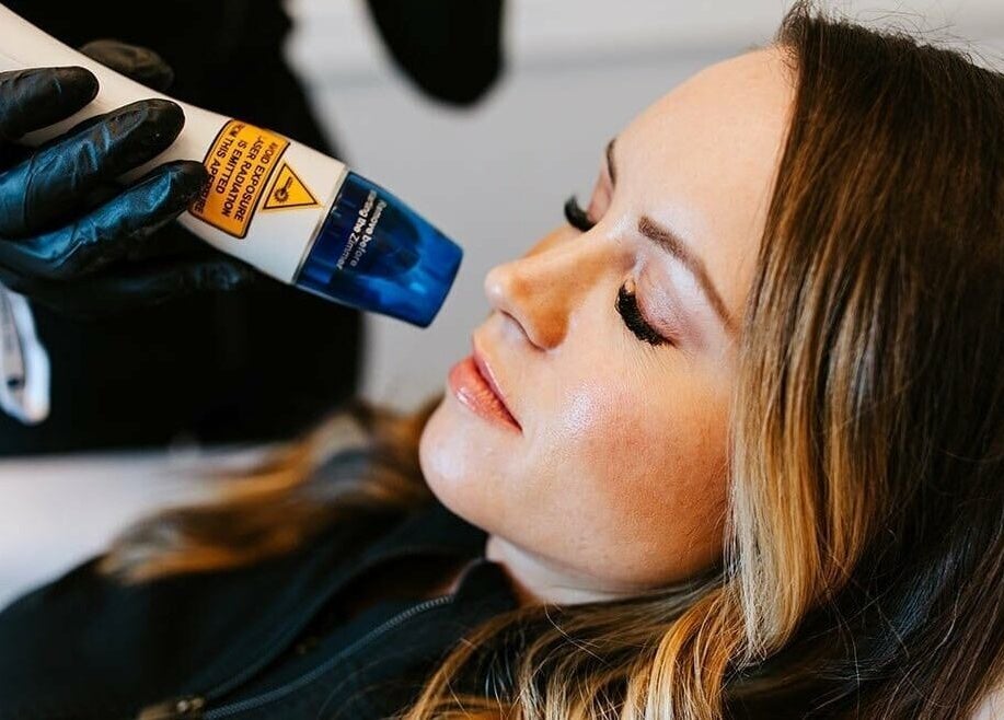 Laser treatment at Austin Laser Med Spa, Cedar Park, Texas, US, enhancing skin's radiance and smoothness.