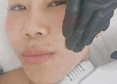 Close-up facial treatment at SP Beauty Bar, Sydney, New South Wales, AU for skin rejuvenation.