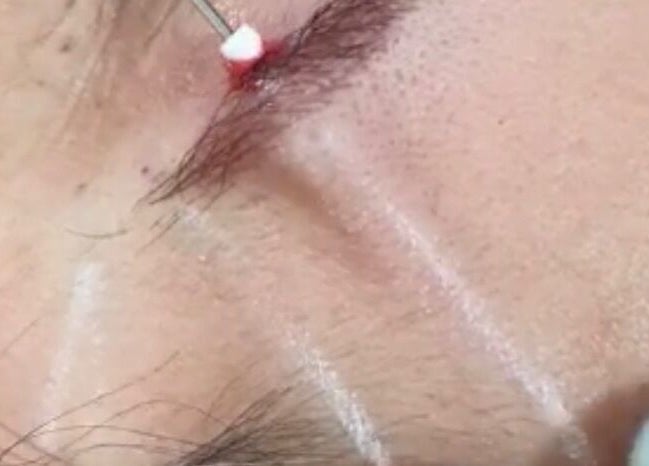 Eyebrow microblading at Hers & Sirs, Manchester, England, GB, enhancing brow definition.