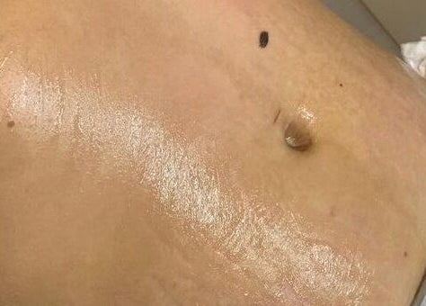 Body treatment at Hers & Sirs, Manchester, England, GB, showcasing smooth, glowing skin.