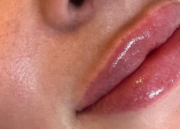 Close-up of glossy lips at Hers & Sirs, Manchester, England, GB showcasing beauty treatment.