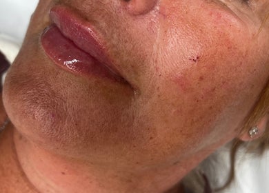Close-up of facial skin treatment at Radiant by Julie, Derby, England, GB, showing smooth, rejuvenated complexion.