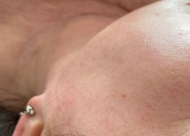Close-up of facial skin treatment at Radiant by Julie, Derby, England, GB showcasing healthy skin.