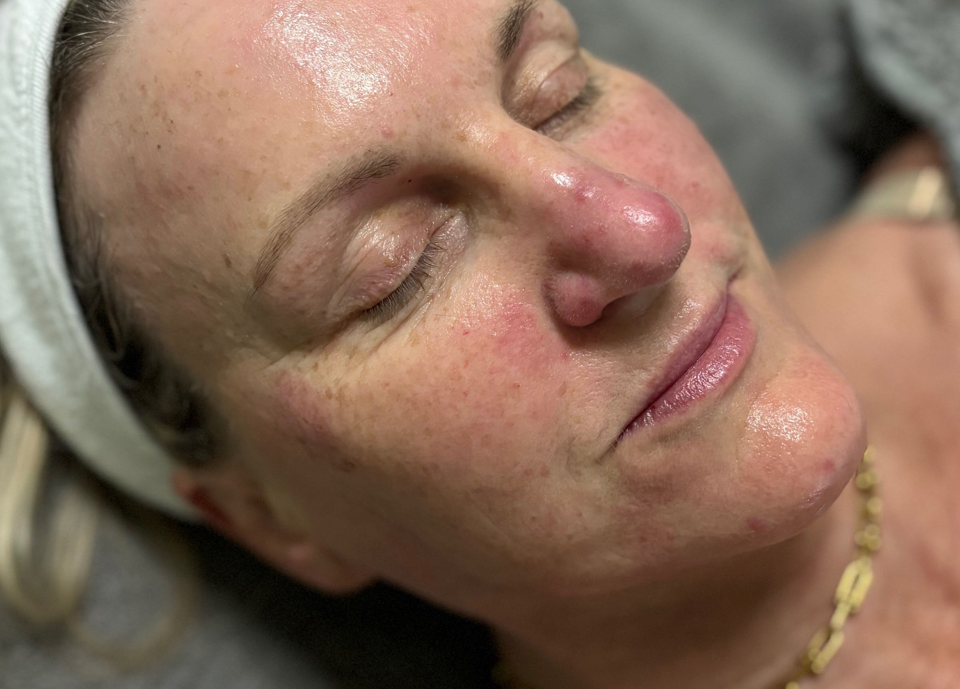 Relaxed woman post-facial at Radiant by Julie, Derby, England, GB, highlighting glowing skin.