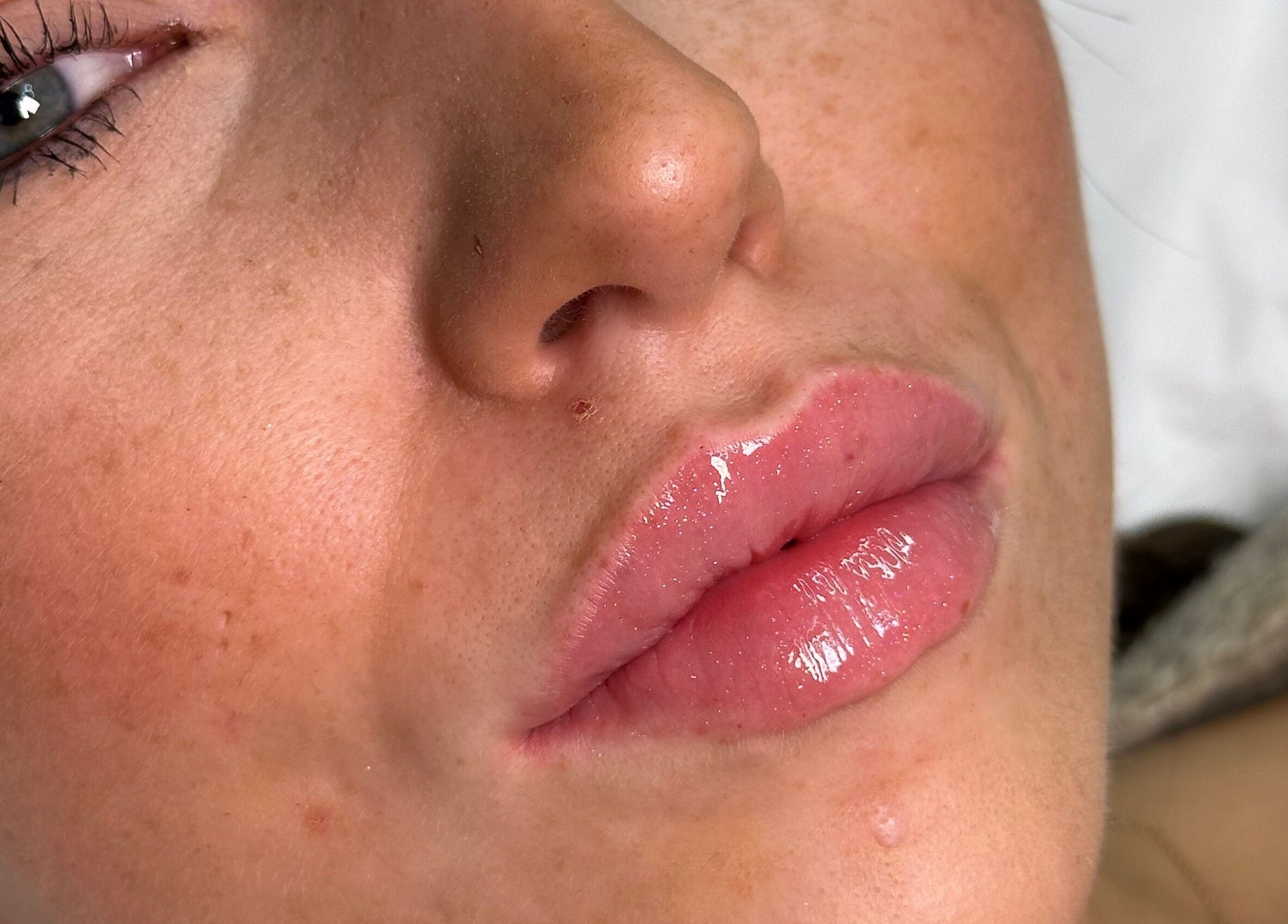 Close-up of glossy lips treatment at The Face Studio, Aston-on-trent, England, GB.