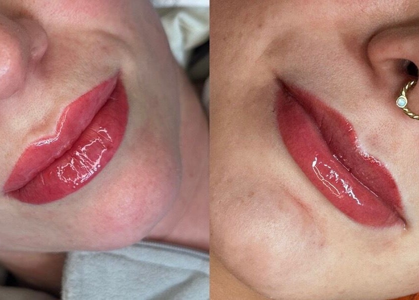 Close-up of glossy, enhanced lips at Rebecca Beards Clinic, Bridgend, Wales, CF31 2ES, GB.