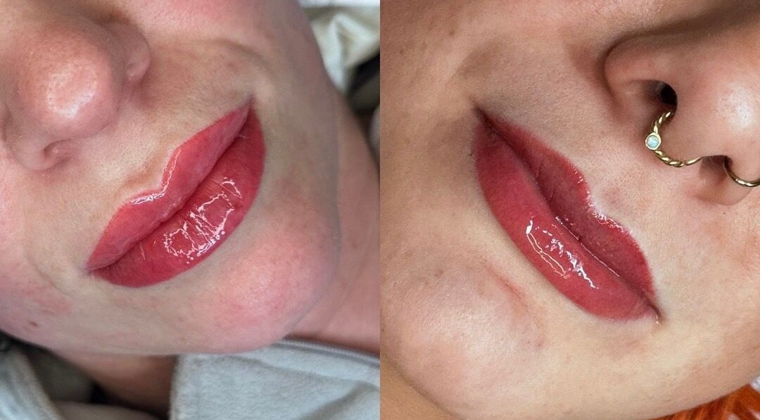 Close-up of glossy, enhanced lips at Rebecca Beards Clinic, Bridgend, Wales, CF31 2ES, GB.