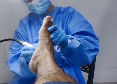 Tratamiento podológico en Quiropedia - Centro Médico Nacional, Panamá, Panamá, PA. Cuidado profesional de pies.