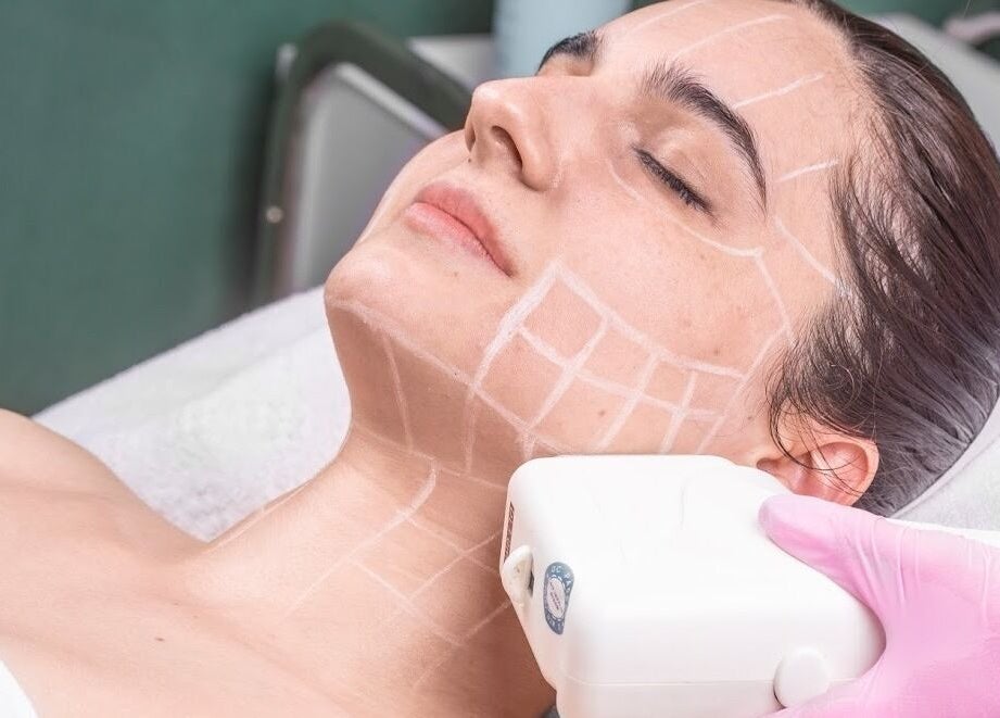 Client receiving a skin treatment at Beautie.Lab Aesthetics in London, England, GB.