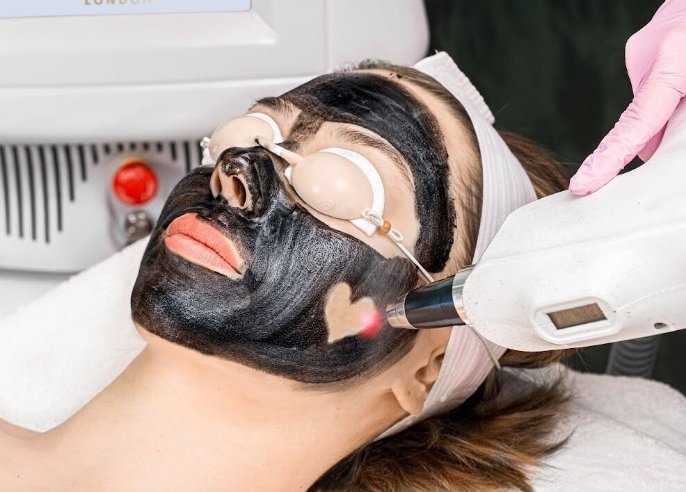 Laser facial treatment at Beautie.Lab Aesthetics in London, England, GB for radiant skin.