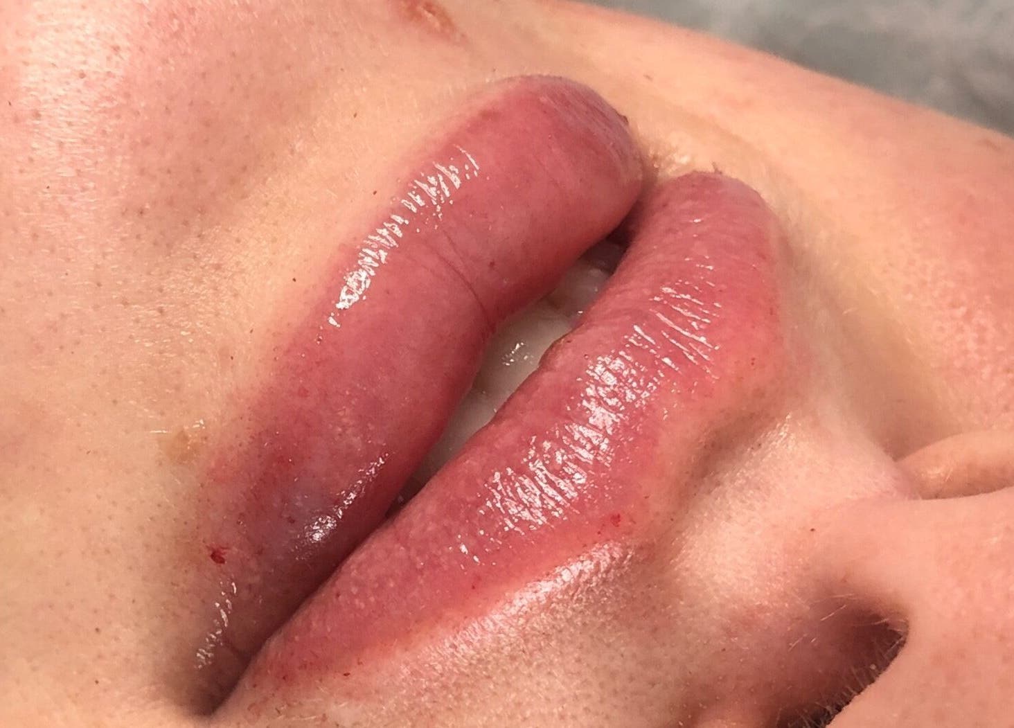 Close-up of glossy lips after treatment at Indybeautyuk, Stilton, England, GB.