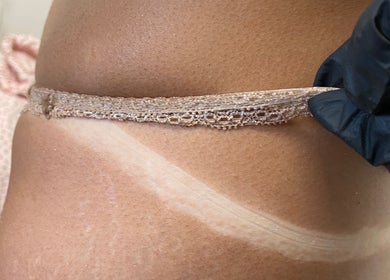 Close-up of tan line showing service quality at Bronze Bar Tanning in Tranent, Scotland, GB.