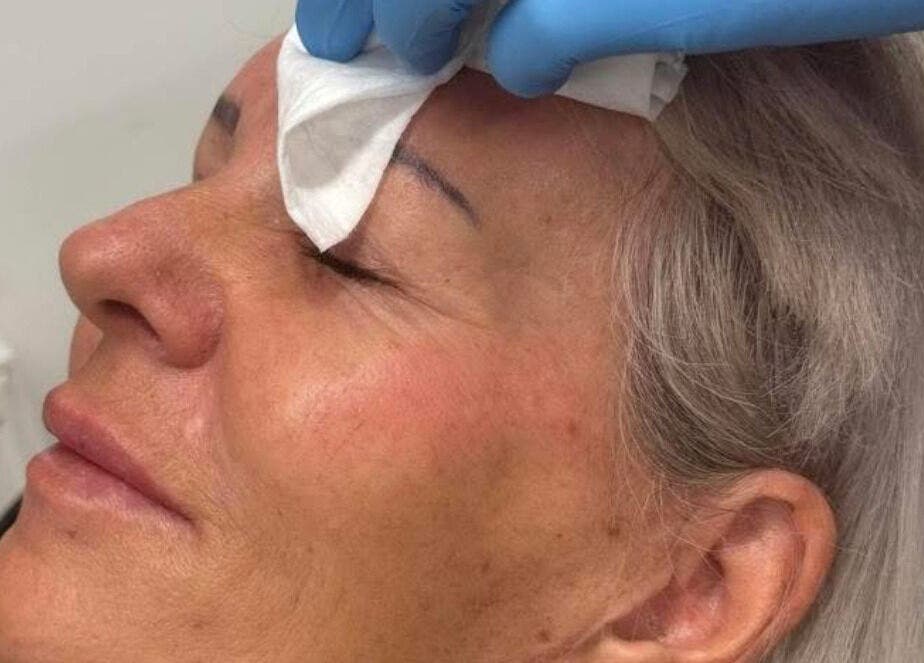 Facial treatment at K&E Pro Aesthetics Ltd in Bar Hill, England, GB, showing a gentle skincare procedure.