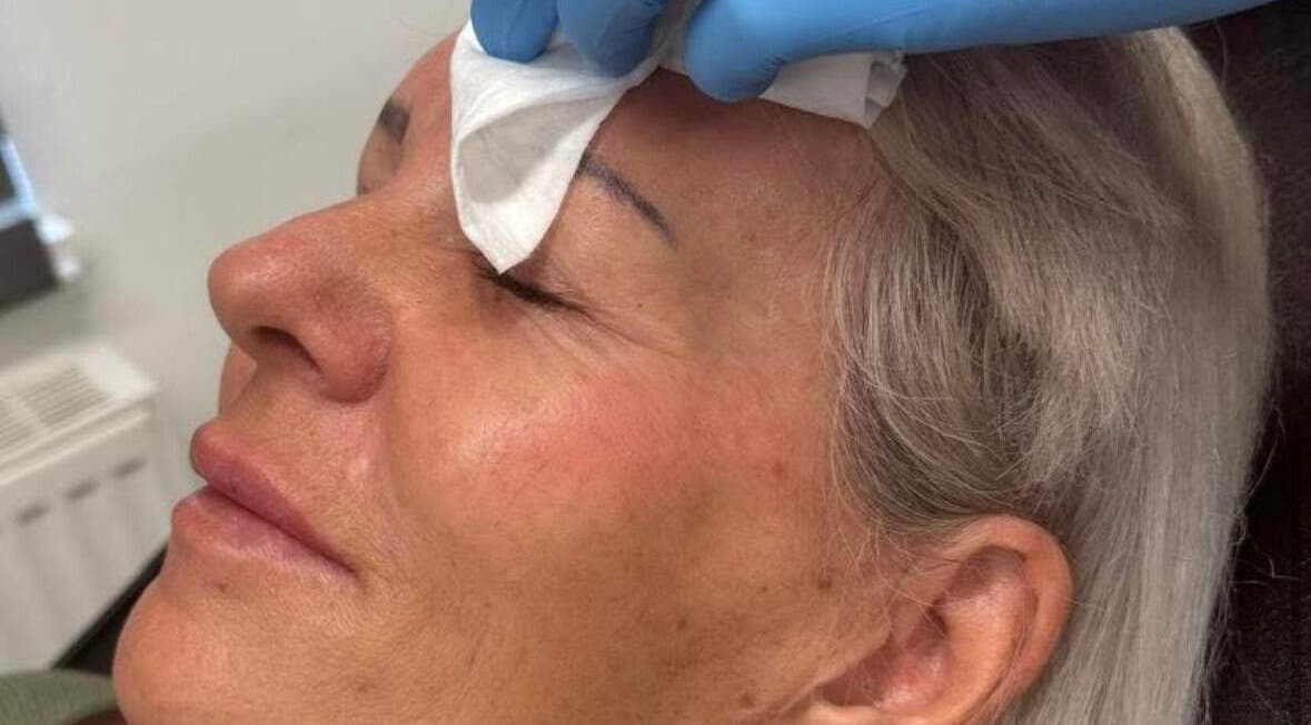 Facial treatment at K&E Pro Aesthetics Ltd in Bar Hill, England, GB, showing a gentle skincare procedure.