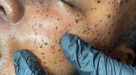 Close-up of facial treatment at Mpumalanga - eMalahleni (@GreenLeaf Day Spa), Emalahleni, Mpumalanga, ZA.