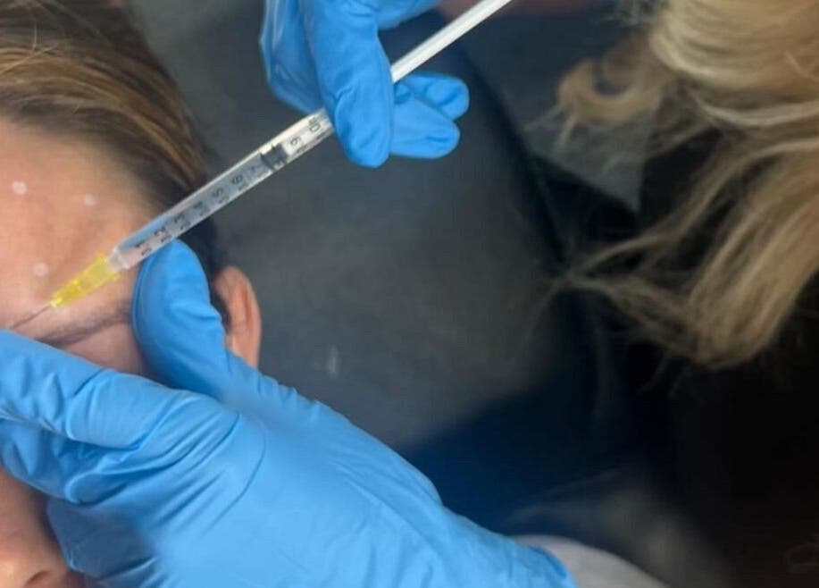 Professional beauty treatment at All Dolled Up - Leeds in Kippax, England, GB, showcasing precision and care.