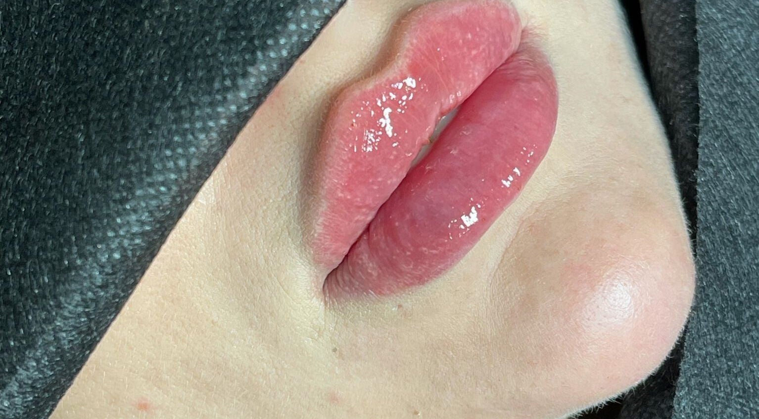 Glossy pink lips enhancement at Reyn Aesthetics & Beauty, London, England, GB.