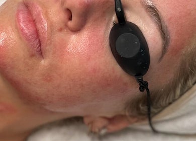 Facial treatment at Be Beau Boutique in Paignton, England, GB, showing a calm client receiving skin care.
