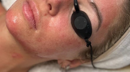 Facial treatment at Be Beau Boutique in Paignton, England, GB, showing a calm client receiving skin care.