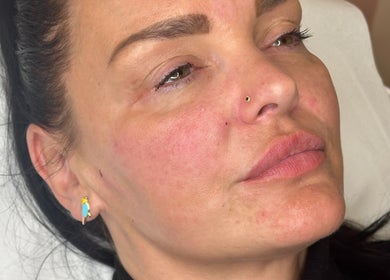 Close-up of client enjoying rejuvenation at Faceology - Hythe, located in Hythe, Lympne, England, GB.