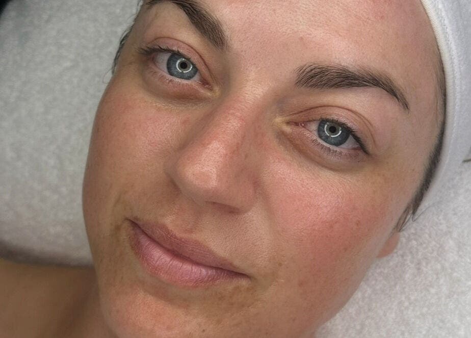 Close-up of a serene face with fresh skin at Faceology, Lympne, Hythe, England, GB.