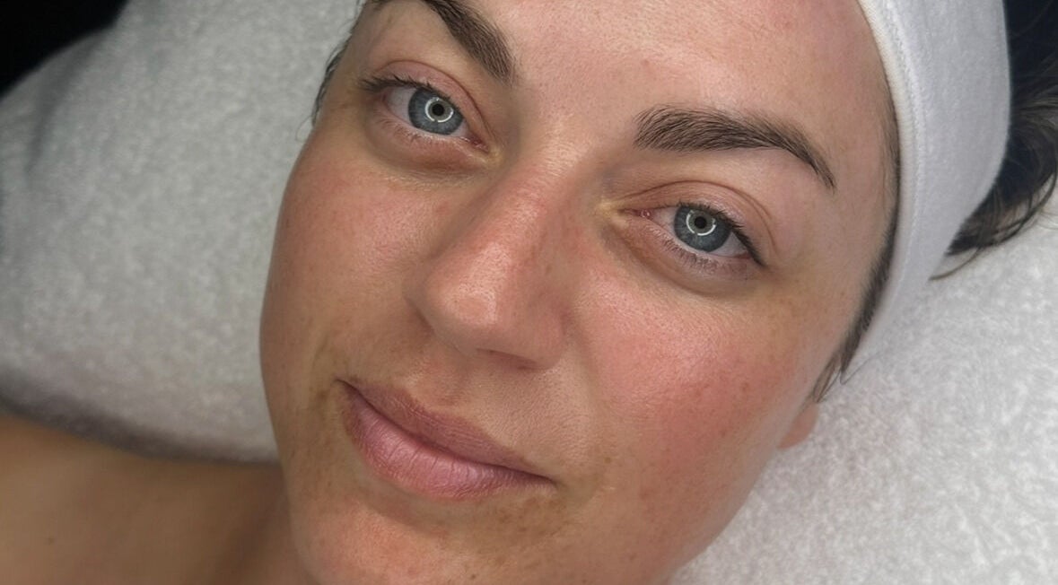 Close-up of a serene face with fresh skin at Faceology, Lympne, Hythe, England, GB.