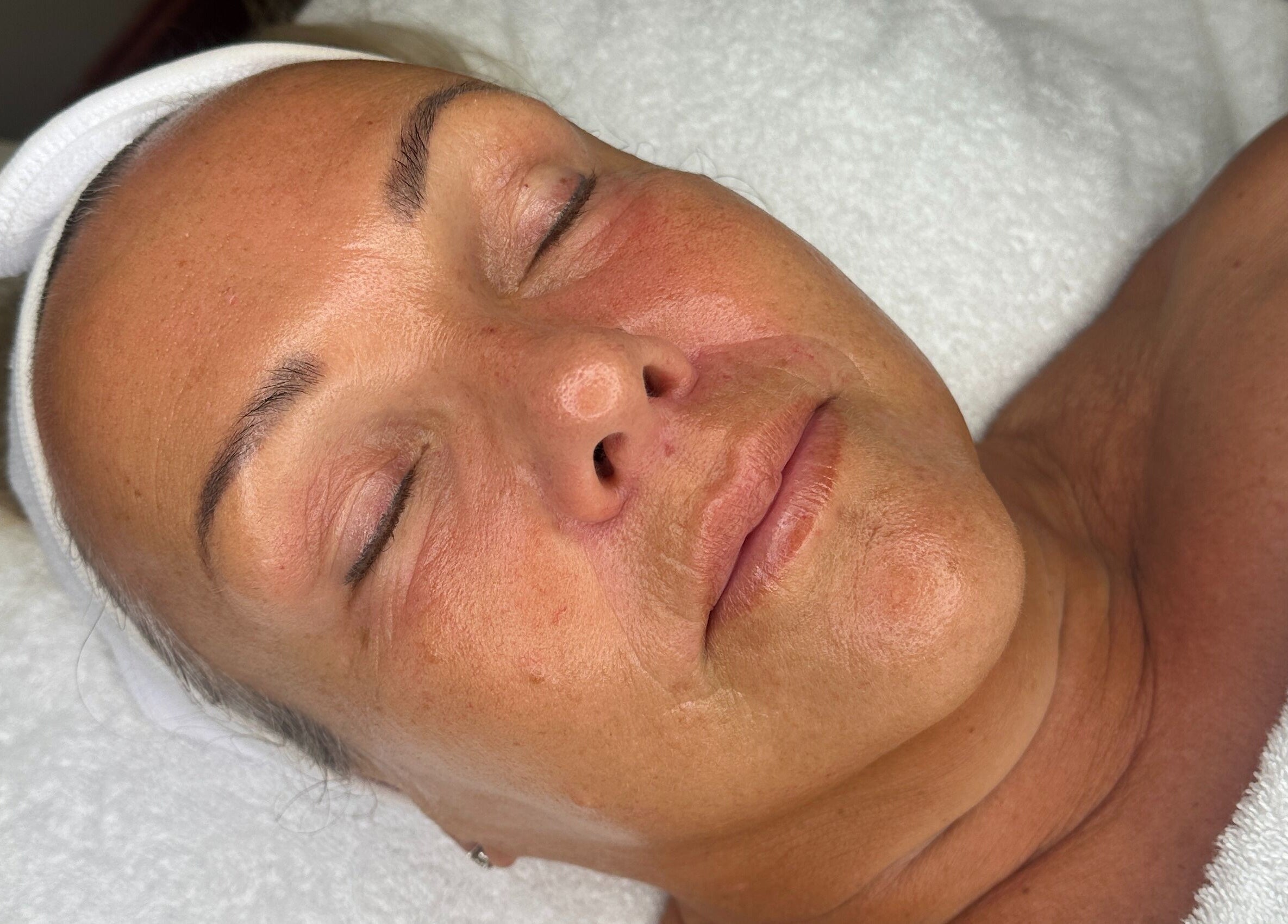 Close-up of a serene face enjoying a relaxing treatment at Faceology, Lympne, Hythe, England.