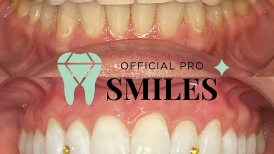 Official Pro Smiles 3