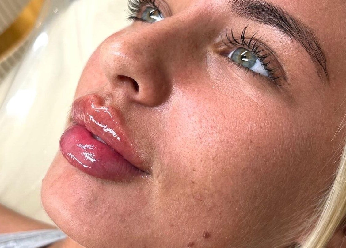 Close-up of glossy lips and glowing skin at Lauren Cosmetic Aesthetics, Wigan, England, GB.