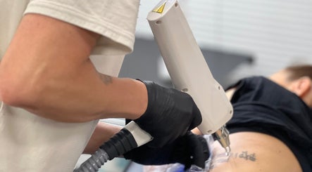 Hình ảnh 2 của TATTOO REMOVAL PRO