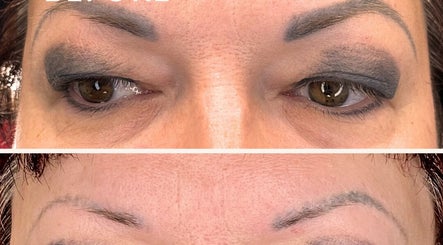 Hình ảnh 3 của TATTOO REMOVAL PRO